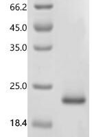 Human immunodeficiency virus type 1 group M subtype B Protein Tat (tat) Recombinant Protein - BioCrest Sci