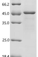Escherichia coli CFA/I fimbrial subunit E(cfaE) Recombinant Protein - BioCrest Sci