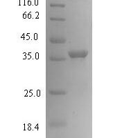 Human Cancer/testis antigen 2 (CTAG2) Recombinant Protein, N-His-SUMO - BioCrest Sci