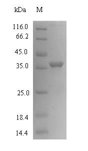 Human Cancer/testis antigen 2 (CTAG2) Recombinant Protein, N-His-SUMO, Homo sapiens (Human), E.coli, N-terminal 6xHis-SUMO-tagged, 37.1 kDa, purity >≥ 90% as determined by SDS-PAGE.