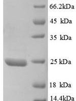 Human Metalloproteinase inhibitor 3 (TIMP3), partial Recombinant Protein - BioCrest Sci