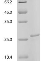 Mouse Interleukin-11 (Il11) Recombinant Protein, N-His, aa 22–199, MW 23.8 kDa - BioCrest Sci