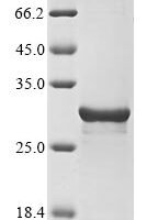 Coturnix coturnix japonica Extracellular fatty acid-binding protein Recombinant Protein - BioCrest Sci