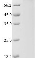 Human Amyloid-beta A4 precursor protein-binding family A member 2 (APBA2) Recombinant Protein, N-10His/C-Myc - BioCrest Sci