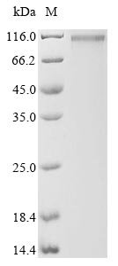 Human Amyloid-beta A4 precursor protein-binding family A member 2 (APBA2) Recombinant Protein, N-10His/C-Myc, Homo sapiens (Human), Mammalian cell, N-terminal 10xHis-tagged and C-terminal Myc-tagged, 87.5 kDa, purity >≥ 85% as determined by SDS-PAGE.