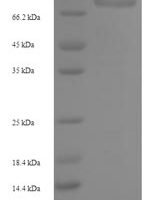 Human Ribonucleoside-diphosphate reductase large subunit (RRM1) Recombinant Protein, N-His-SUMO - BioCrest Sci