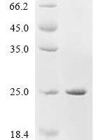 Rat Sodium channel protein type 10 subunit alpha (Scn10a), partial Recombinant Protein - BioCrest Sci