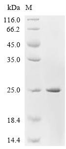 Rat Sodium channel protein type 10 subunit alpha (Scn10a), partial Recombinant Protein, Rattus norvegicus (Rat), E.coli, C-terminal 6xHis-tagged, 21.3 kDa, purity >≥ 85% as determined by SDS-PAGE.