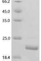 Mouse Tumor necrosis factor (Tnf), partial, Biotinylated Recombinant Protein - BioCrest Sci