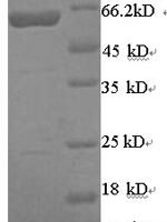 Human Arylsulfatase B (ARSB) Recombinant Protein, N-His-SUMO - BioCrest Sci