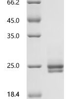 Human Interleukin-6 (IL6) Recombinant Protein, C-10His - BioCrest Sci