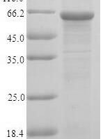 Human UDP-N-acetylhexosamine pyrophosphorylase (UAP1) Recombinant Protein, N-His, aa 1–522, E.coli - BioCrest Sci