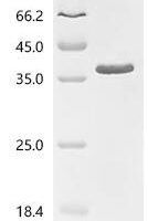 Human TATA-binding protein-associated factor 2N (TAF15), partial Recombinant Protein, C-His, aa 110–304 - BioCrest Sci