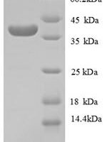 Human Collagen alpha-1 (IV) chain (COL4A1), partial Recombinant Protein, N-GST - BioCrest Sci