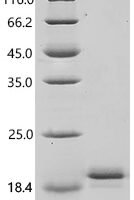 Mouse Fibroblast growth factor 1 (Fgf1) Recombinant Protein, N-His, aa 16–155, Yeast - BioCrest Sci