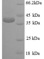Human Cyclic AMP-responsive element-binding protein 1 (CREB1) Recombinant Protein - BioCrest Sci