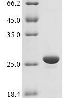 Francisella tularensis subsp. holarctica 17 kDa major membrane protein (FTL_0421) Recombinant Protein - BioCrest Sci