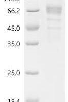 Human Sodium-dependent phosphate transport protein 2B (SLC34A2), partial Recombinant Protein, C-mFc - BioCrest Sci
