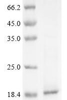 Human C-X-C motif chemokine 13 (CXCL13) Recombinant Protein - BioCrest Sci