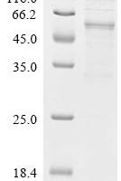 Human Lysophospholipase D GDPD3 (GDPD3) Recombinant Protein - BioCrest Sci