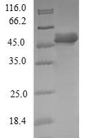 Human Dynactin subunit 6 (DCTN6) Recombinant Protein - BioCrest Sci