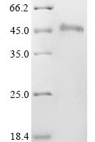 Human Hypoxia-inducible factor 1-alpha inhibitor (HIF1AN) Recombinant Protein, C-His - BioCrest Sci