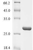 Influenza A virus Polymerase basic protein 2 (PB2), partial Recombinant Protein - BioCrest Sci