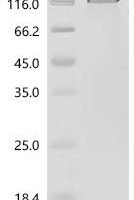 Human Delta and Notch-like epidermal growth factor-related receptor (DNER), partial Recombinant Protein, C-hFc1 - BioCrest Sci
