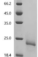 Mouse Kit ligand (Kitlg), partial Recombinant Protein - BioCrest Sci