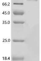 Human Protein kinase C-binding protein NELL2 (NELL2) Recombinant Protein - BioCrest Sci