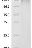 Human T-cell differentiation antigen CD6(CD6), partial Recombinant Protein - BioCrest Sci