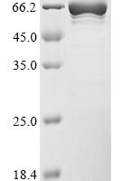 Mouse Tyrosine-protein phosphatase non-receptor type 6 (Ptpn6) Recombinant Protein - BioCrest Sci