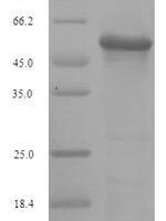 Influenza A virus Hemagglutinin (HA), partial Recombinant Protein, N-His-SUMO, aa 16–339, strain A/Korea/426/1968 H2N2 - BioCrest Sci