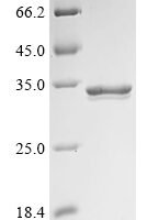 Staphylococcus aureus Exfoliative toxin B (etb) Recombinant Protein - BioCrest Sci