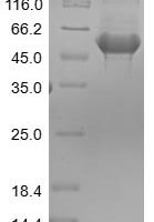 Rat Pyruvate kinase PKM (Pkm) Recombinant Protein - BioCrest Sci