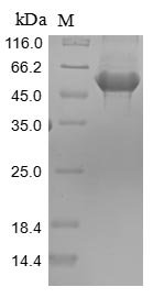 Rat Pyruvate kinase PKM (Pkm) Recombinant Protein, Rattus norvegicus (Rat), Mammalian cell, N-terminal 10xHis-tagged and C-terminal Myc-tagged, 61.8 kDa, purity >≥ 85% as determined by SDS-PAGE.