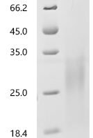 Human Mucin-13(MUC13), partial Recombinant Protein - BioCrest Sci