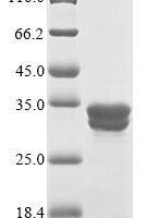 Human C-C chemokine receptor type 9 (CCR9), partial Recombinant Protein - BioCrest Sci