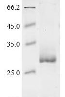 Human Acetylcholine receptor subunit gamma (CHRNG), partial Recombinant Protein, N-His - BioCrest Sci