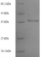 Human Adenylate kinase isoenzyme 1 (AK1) Recombinant Protein - BioCrest Sci