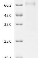 Human Heterogeneous nuclear ribonucleoprotein H2 (IL36G) Recombinant Protein - BioCrest Sci