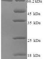 Human papillomavirus type 16 Minor capsid protein L2 (L2) Recombinant Protein - BioCrest Sci