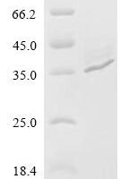 Vibrio cholerae serotype O1 Sialidase (nanH), partial Recombinant Protein, N-His-SUMOstar - BioCrest Sci