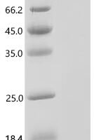 Human Myosin-10 (MYH10), partial Recombinant Protein - BioCrest Sci