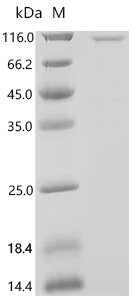 Human Myosin-10 (MYH10), partial Recombinant Protein, Homo sapiens (Human), E.coli, N-terminal GST-tagged, 94.1 kDa, purity >≥ 85% as determined by SDS-PAGE.