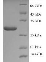 Saccharomyces cerevisiae Neutral trehalase (NTH1), partial Recombinant Protein, N-His, aa 3–221 - BioCrest Sci