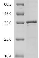 Pig Interleukin-2 receptor subunit alpha (IL2RA), partial Recombinant Protein, C-His, aa 22–245, E.coli - BioCrest Sci