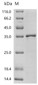 Pig Interleukin-2 receptor subunit alpha (IL2RA), partial Recombinant Protein, C-His, aa 22–245, E.coli, Sus scrofa (Pig), E.coli, C-terminal 6xHis-tagged, 32.2 kDa, purity >≥ 85% as determined by SDS-PAGE.