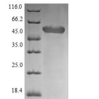 Staphylococcus aureus Autolysin (lytA) Recombinant Protein - BioCrest Sci