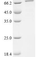 Human Polyamine deacetylase HDAC10 (HDAC10) Recombinant Protein - BioCrest Sci